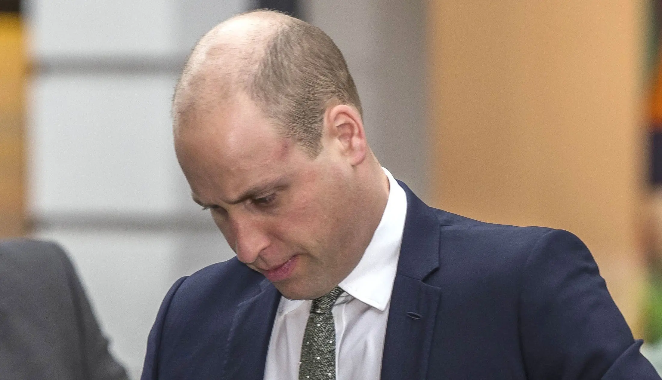 Haarige Sache - Prinz William hat das Problem vieler Männer: die Haare werden weniger