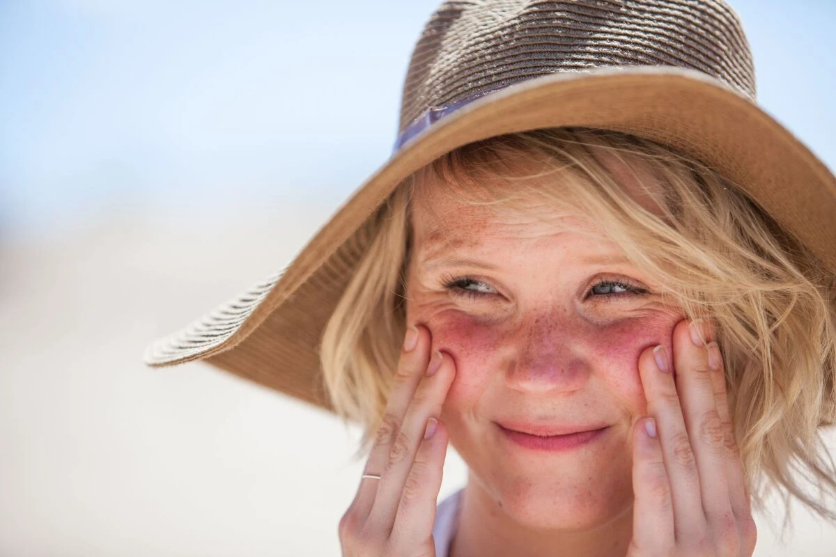 Bei starker Sonneneinstrahlung sollte man auf guten UV-Schutz setzen