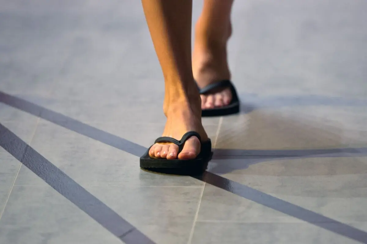 Wer eine Fußfehlstellung hat, sollte es mit den Flipflops nicht übertreiben