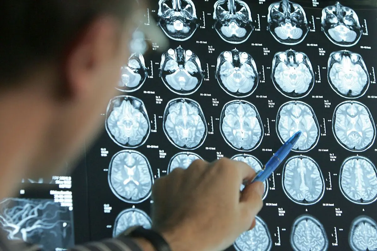 ++ ARCHIVBILD ++ Bei einem Schlaganfall zählt jede Minute