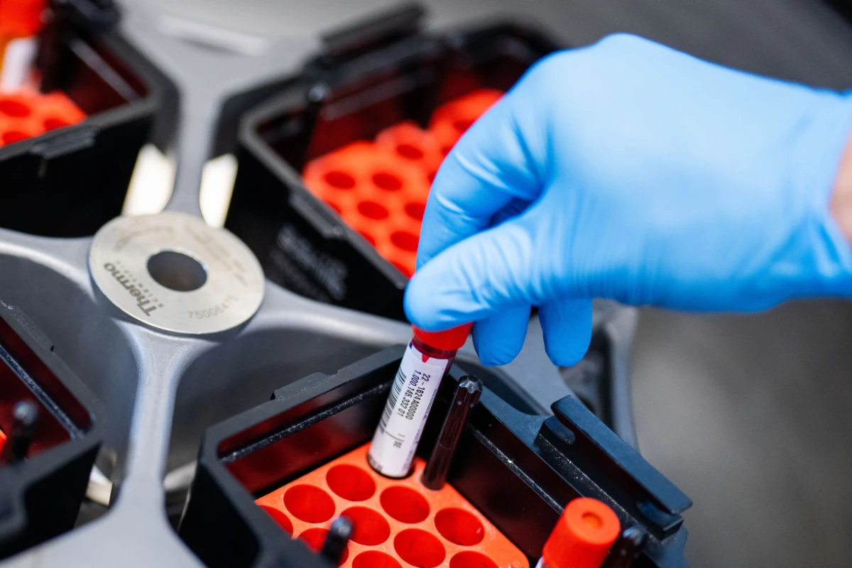 PTX-3-Spiegel bei Betroffenen zehn Wochen nach Infektion stark erhöht