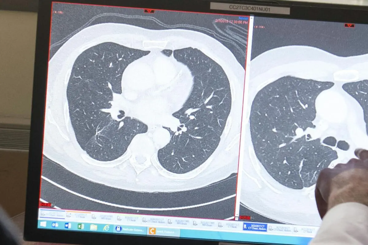 Blick auf einen Tumor