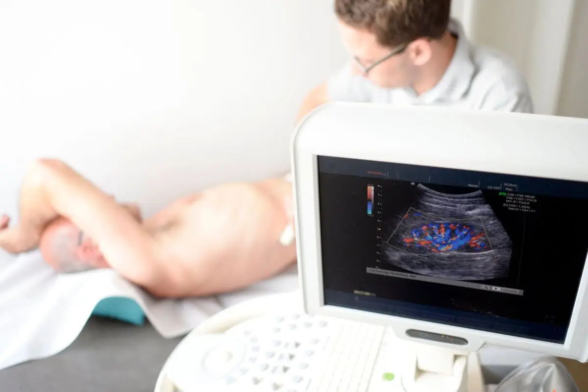 ++ ARCHIVBILD ++ Immer mehr Menschen leiden unter chronischen Nierenkrankheiten