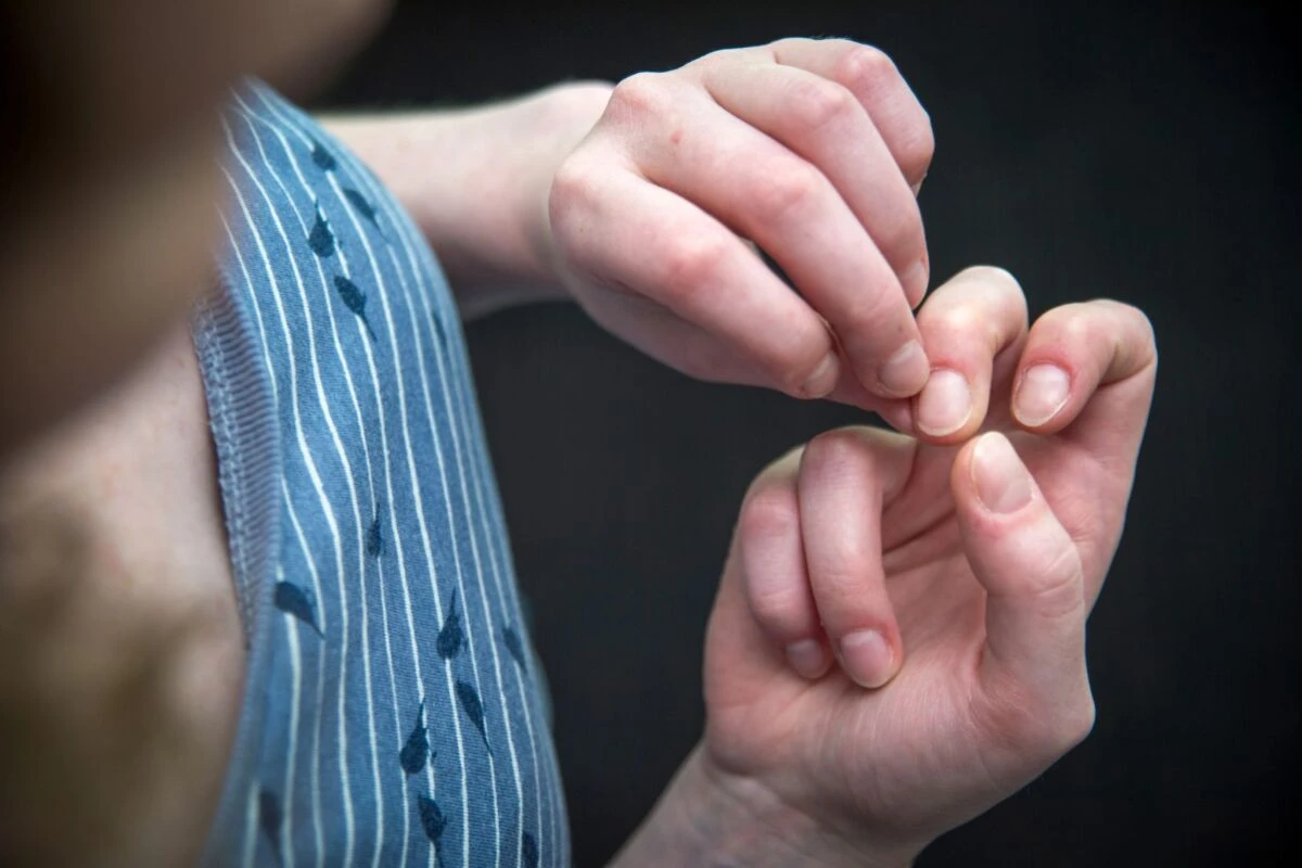Körperfokussierte repetitive Verhaltensweisen sind weit verbreitet