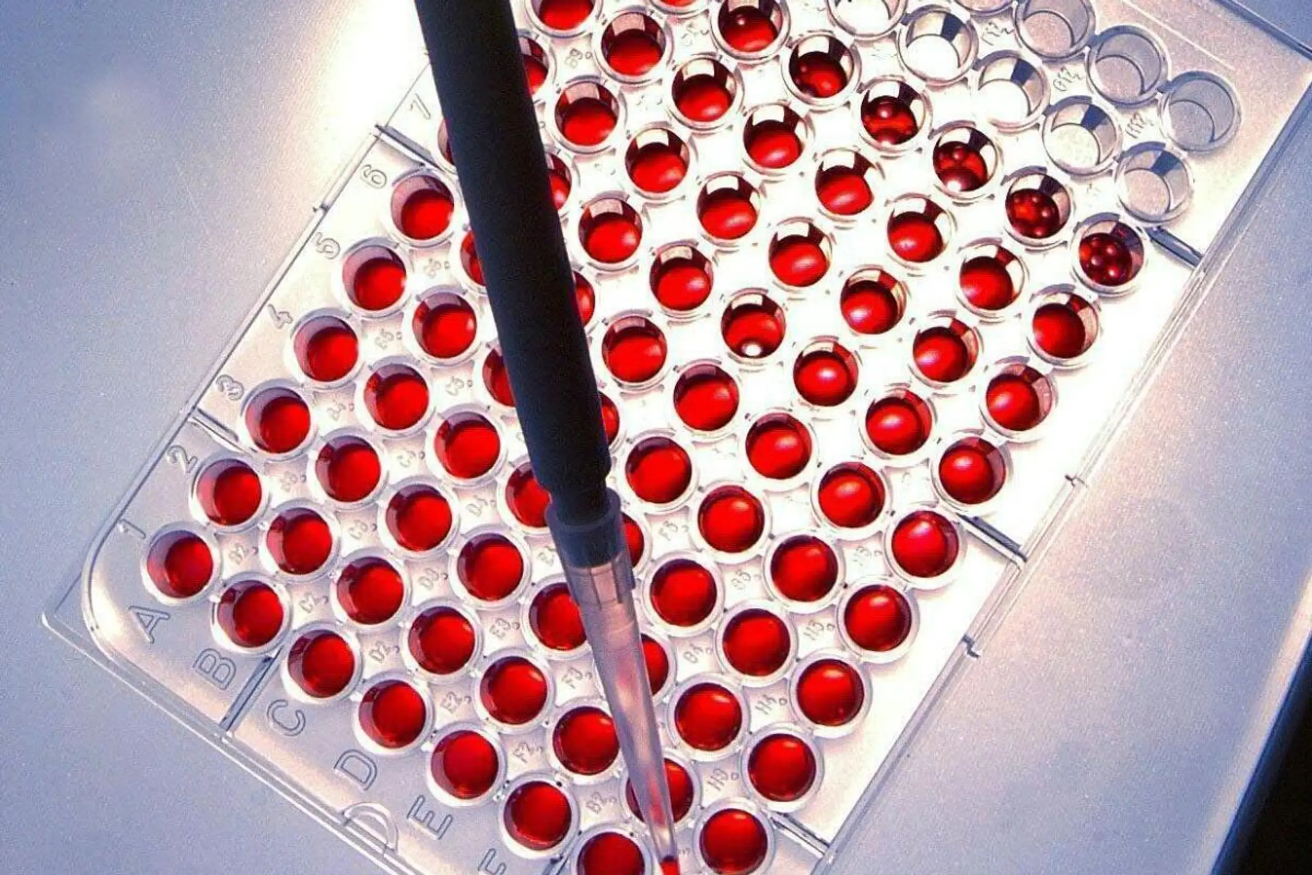 In Zellen ohne Spop wüten häufiger NUP98-Chimären