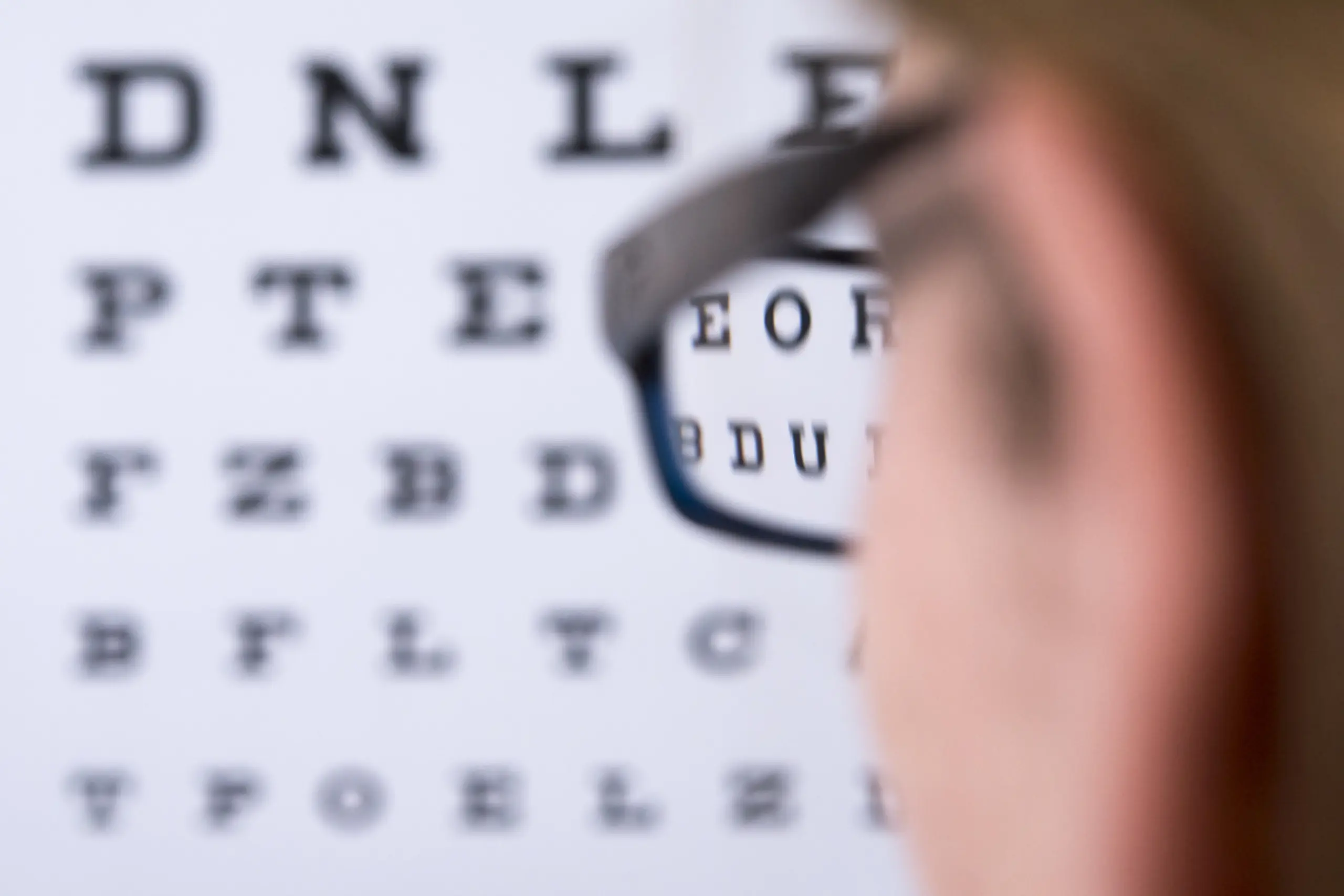 Der Startpunkt für Kurzsichtigkeit liegt zumeist in der Kindheit