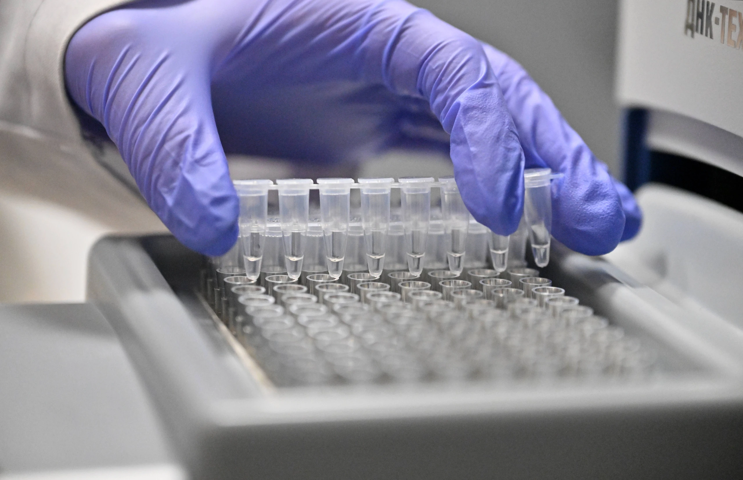 © IMAGO / SNA Blurred image background