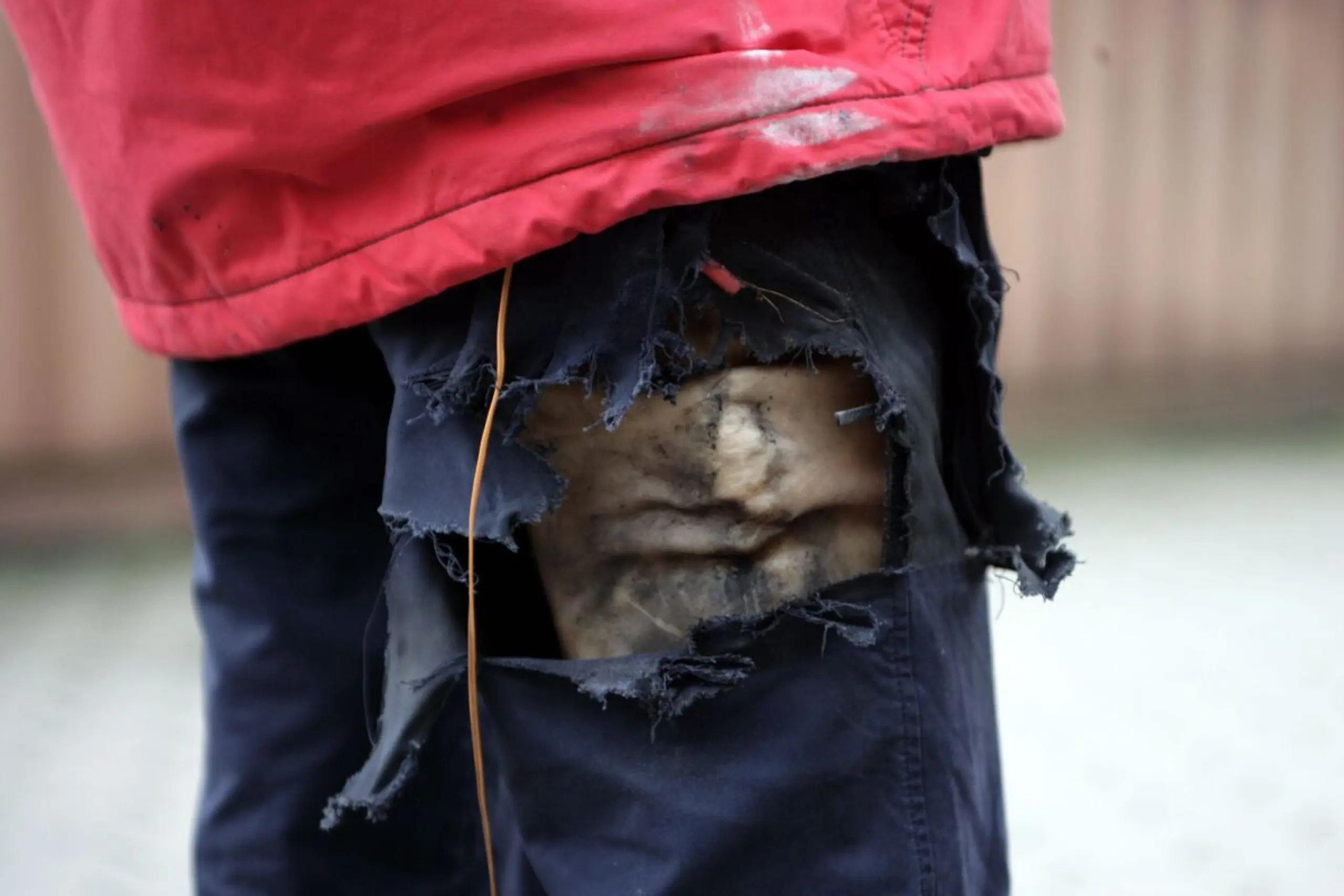 ++ ARCHIVBILD ++ Hohe Verletzungsgefahr: Böller gehören nicht in Hosen oder Jackentaschen
