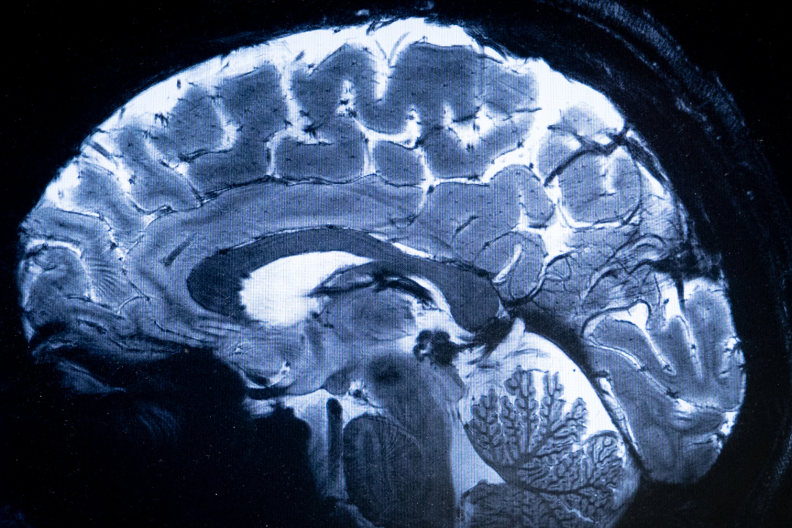 Ein Querschnitt durch's Gehirn