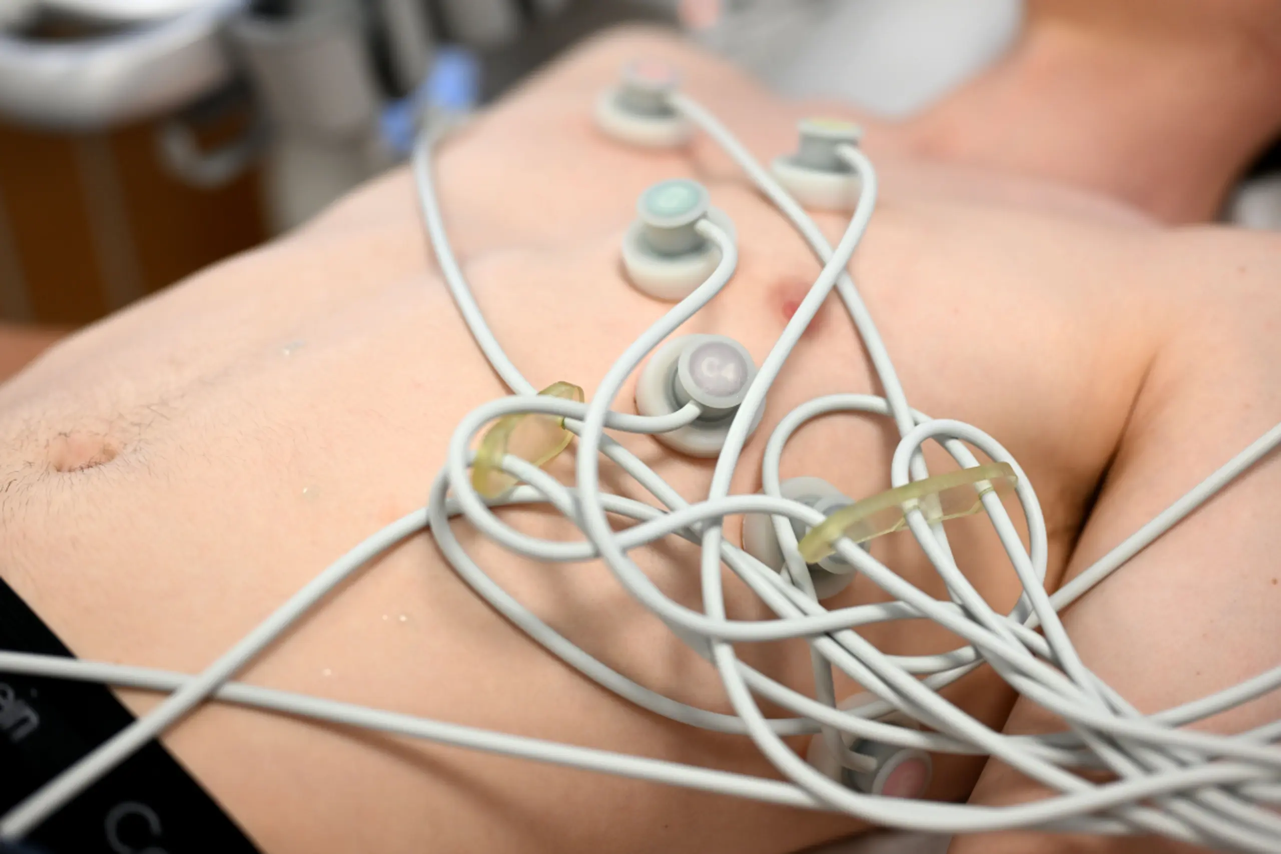 Software kann Anzeichen von Herzinsuffizienz aus EKG-Daten auslesen