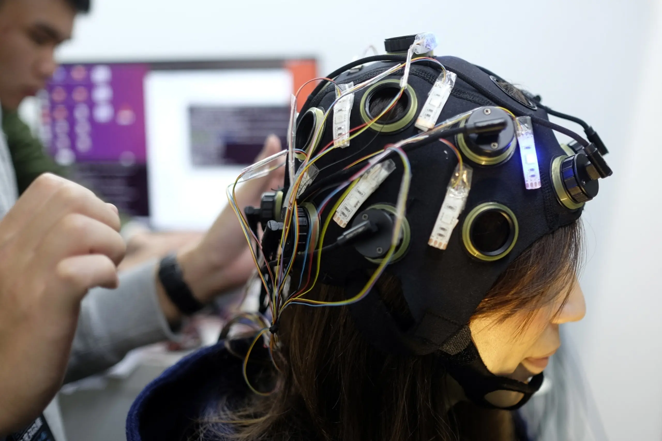 Stimulation von Frontal- und Parietallappen zeigte Wirkung