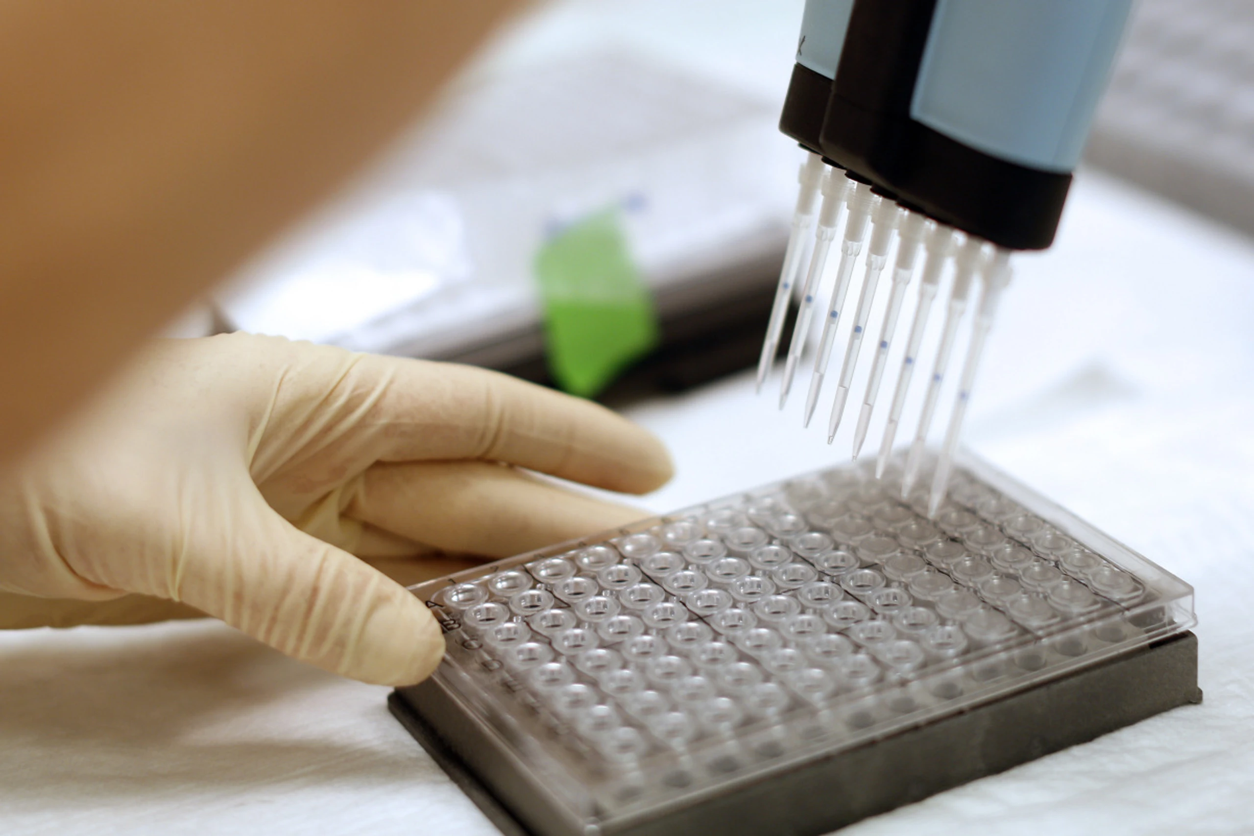 Eiweiß beeinflusst auch die Immunantwort der Haut