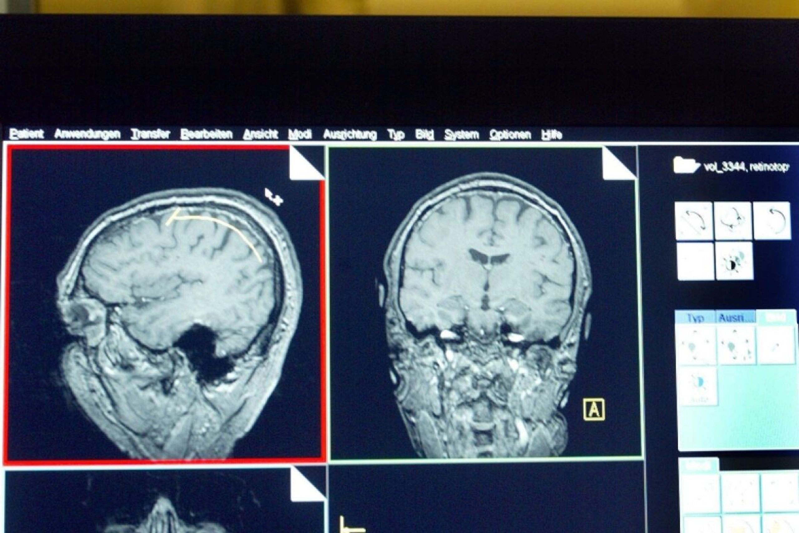 Großes Potenzial wird in der Prävention gesehen