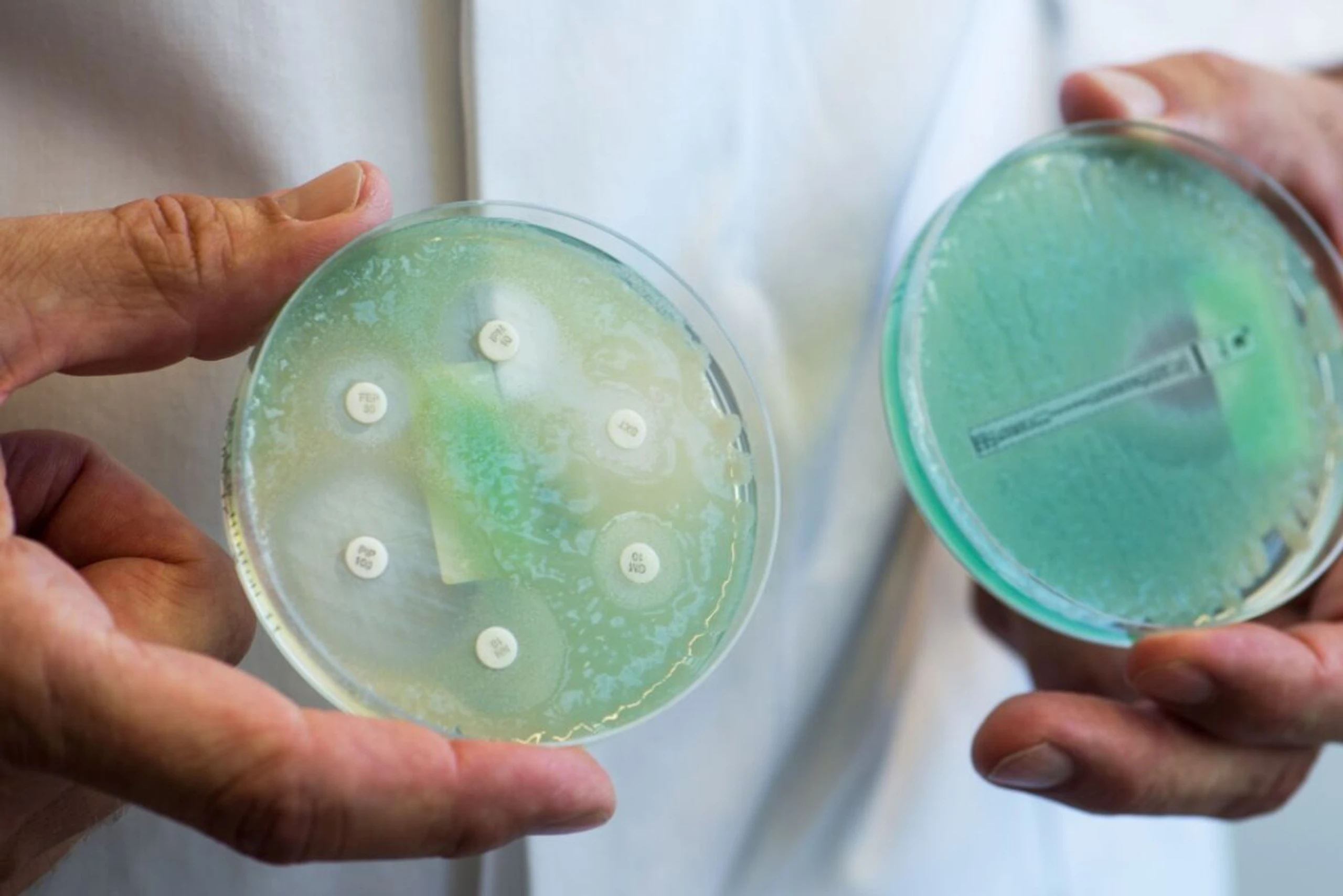 ++ ARCHIVBILD ++ Altes Antibiotika wirksamer gemacht