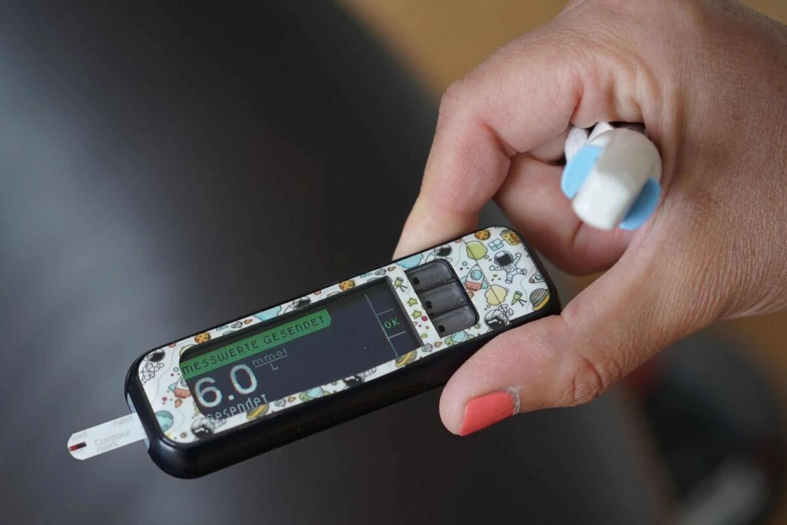 Zöliakie tritt bei Kindern mit Typ-1-Diabetes häufiger auf