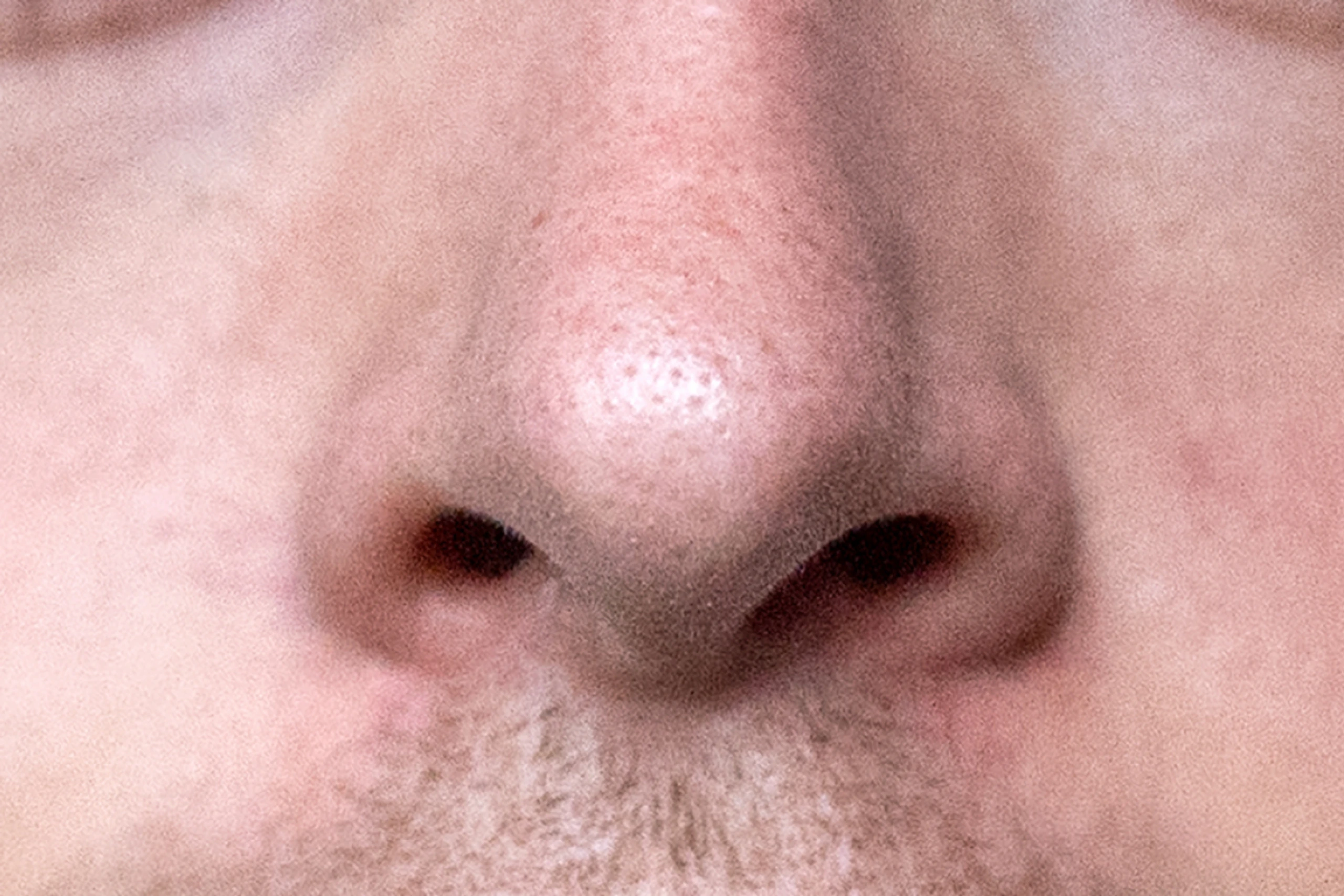 10,7 Prozent der Österreicher haben Geruchseinschränkungen