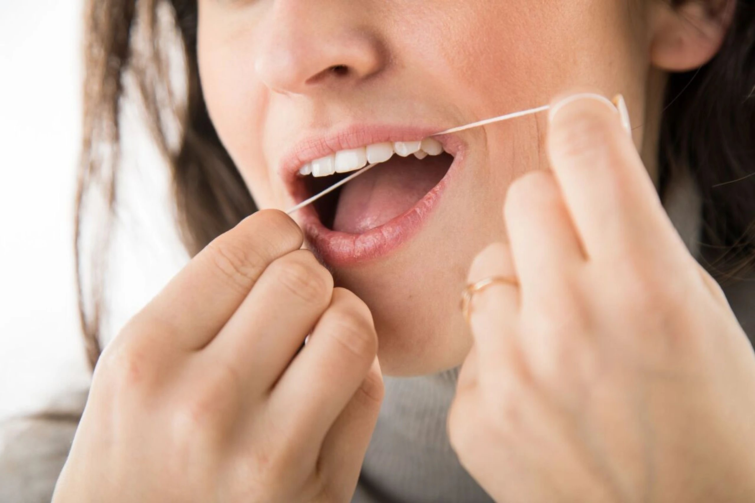 Auch Implantate brauchen gründliche Pflege