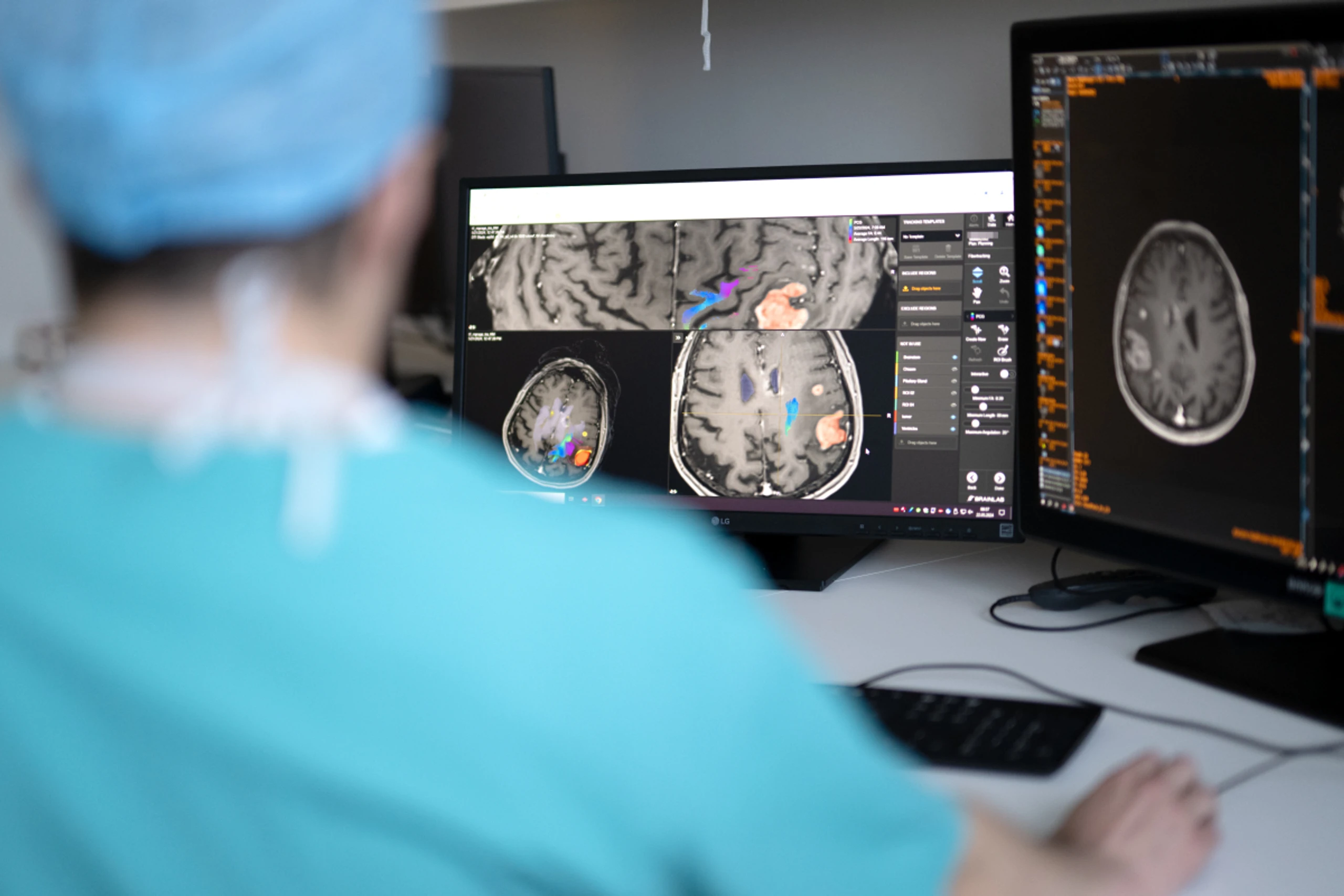 Etwa bei Transgender-Operationen, Brustoperationen oder Handchirurgie