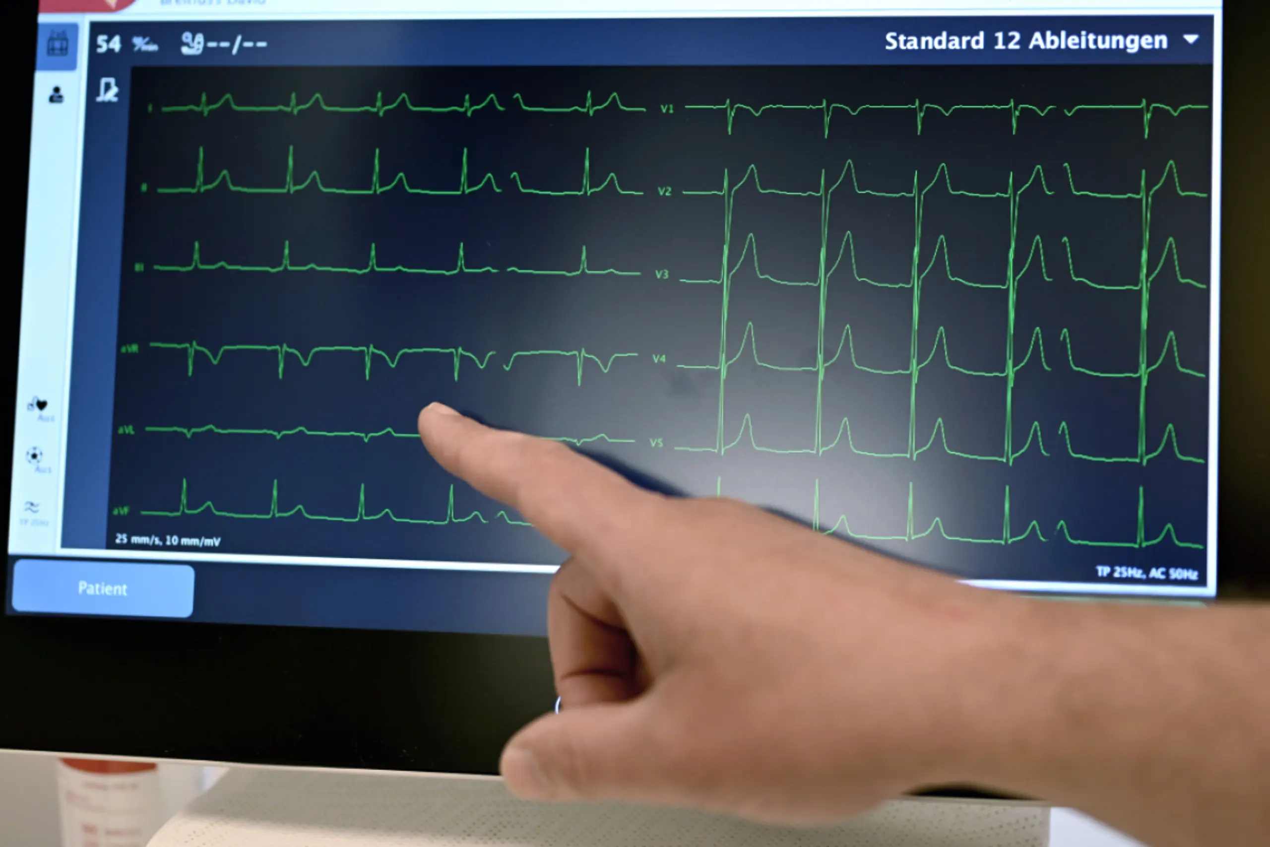 Patienten werden ermutigt eine Reha nach einem Herzinfarkt zu machen