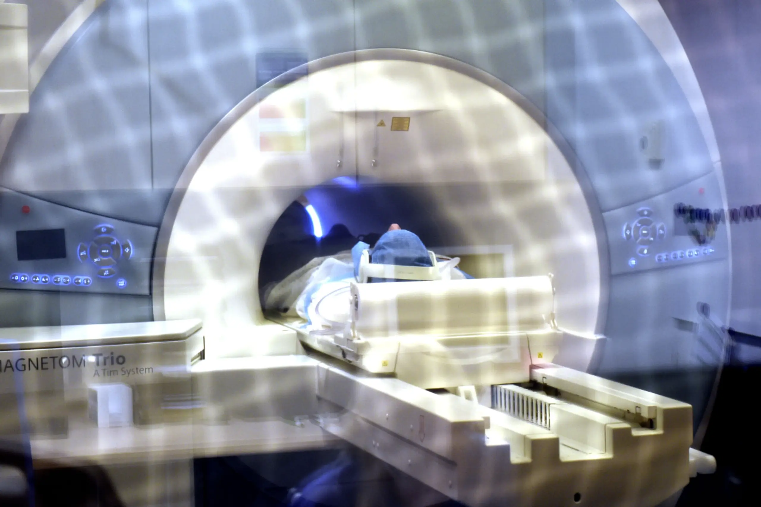 MRT-Daten von mehr als 800 Betroffenen wurden untersucht