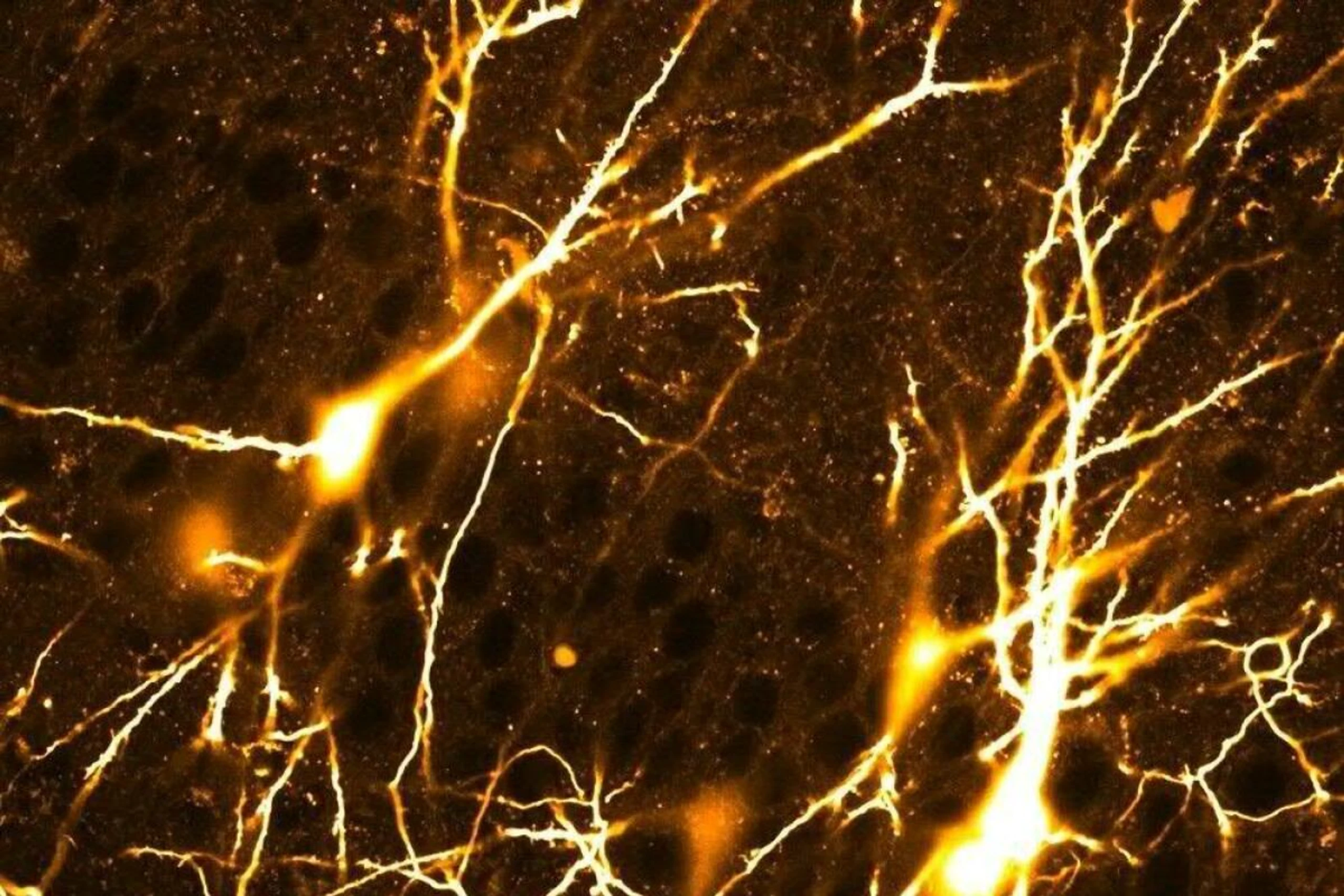 Jung: Netzwerk miteinander verbundener CA3-Pyramiden-Neuronen