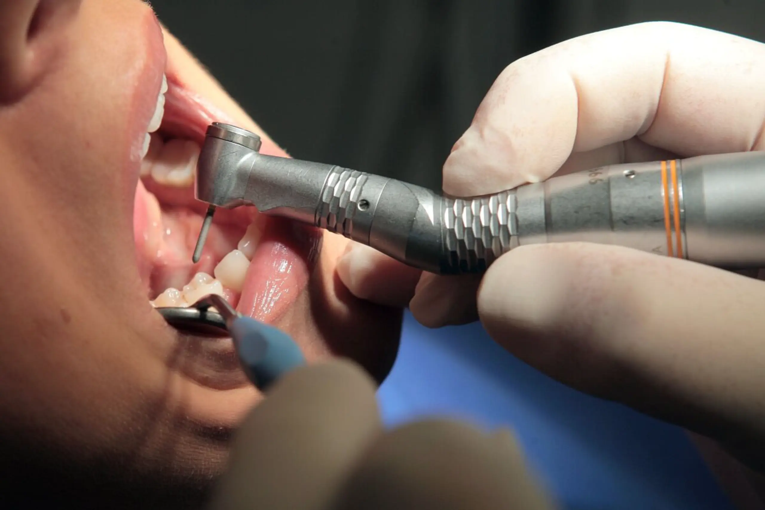 Wer die Zähne schön hat, wirkt attraktiver