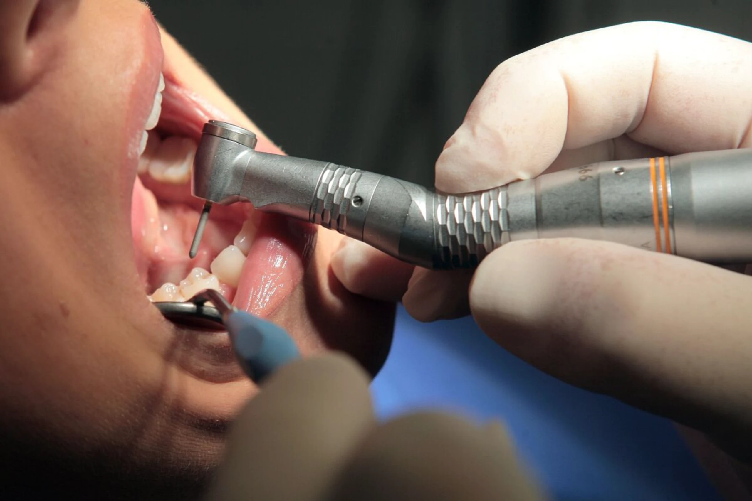 Wer die Zähne schön hat, wirkt attraktiver