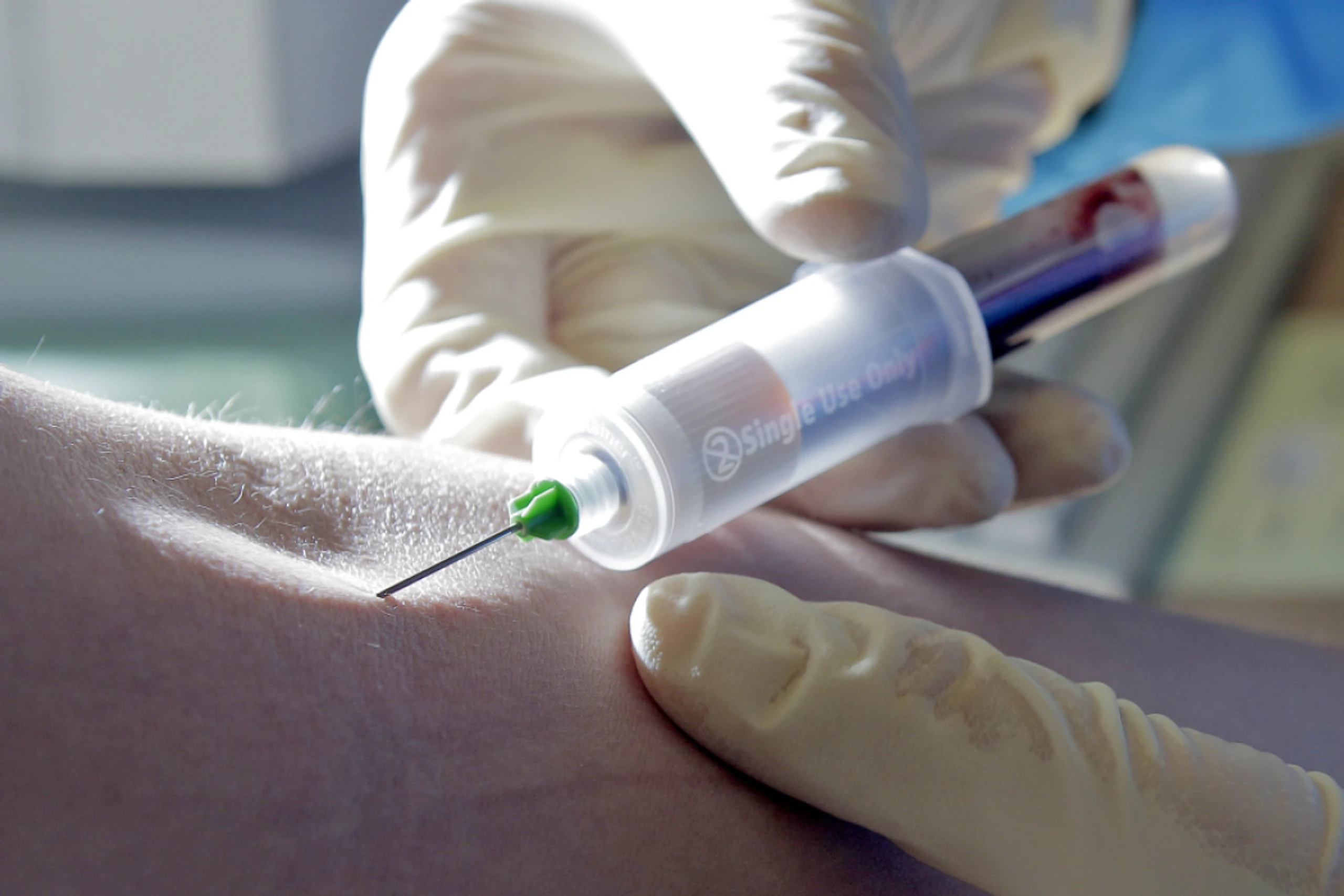 Test erfolgt mittels Blutprobe