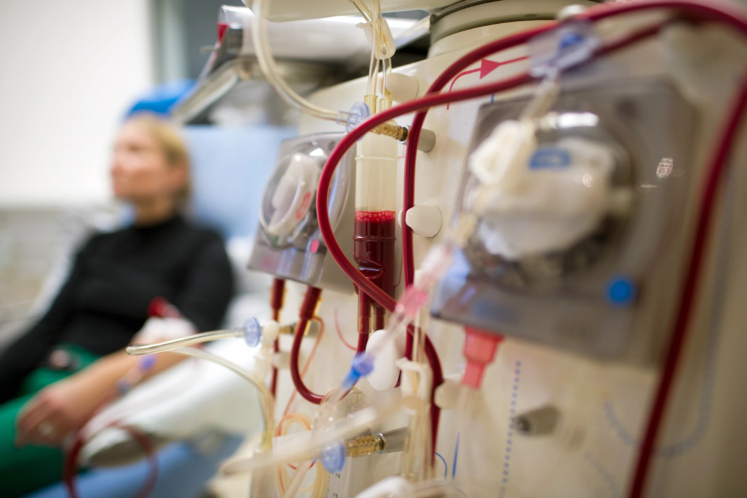 Dialyse ist oft die einzige lebensrettende Therapie