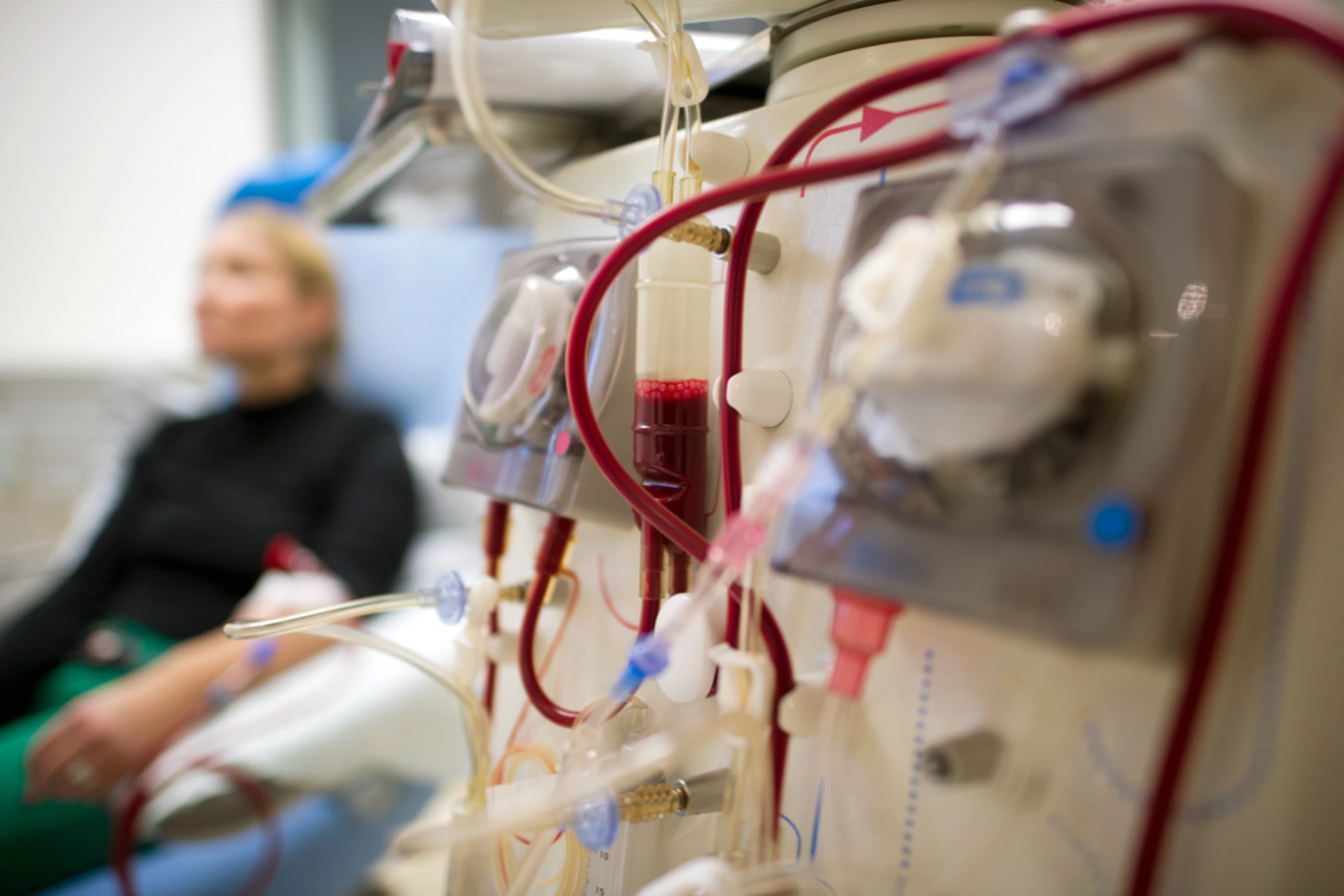 Heimdialyse führt häufig zu entzündlichen Komplikationen