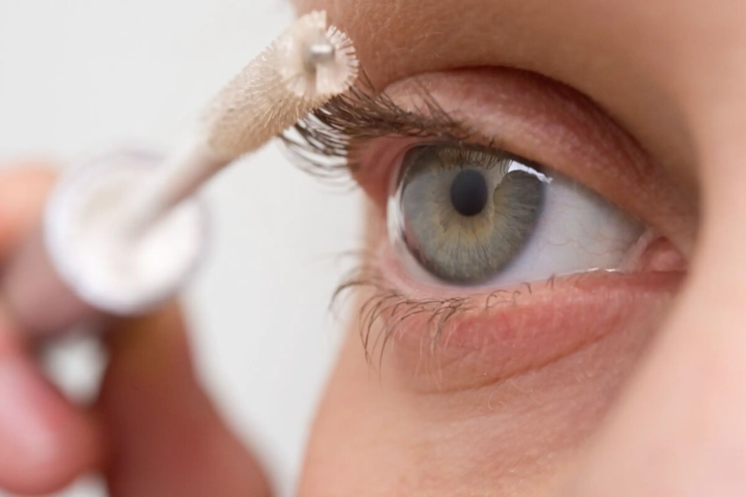 Die Haut unter den Augen kann mit der Zeit mehr Melanin einlagern