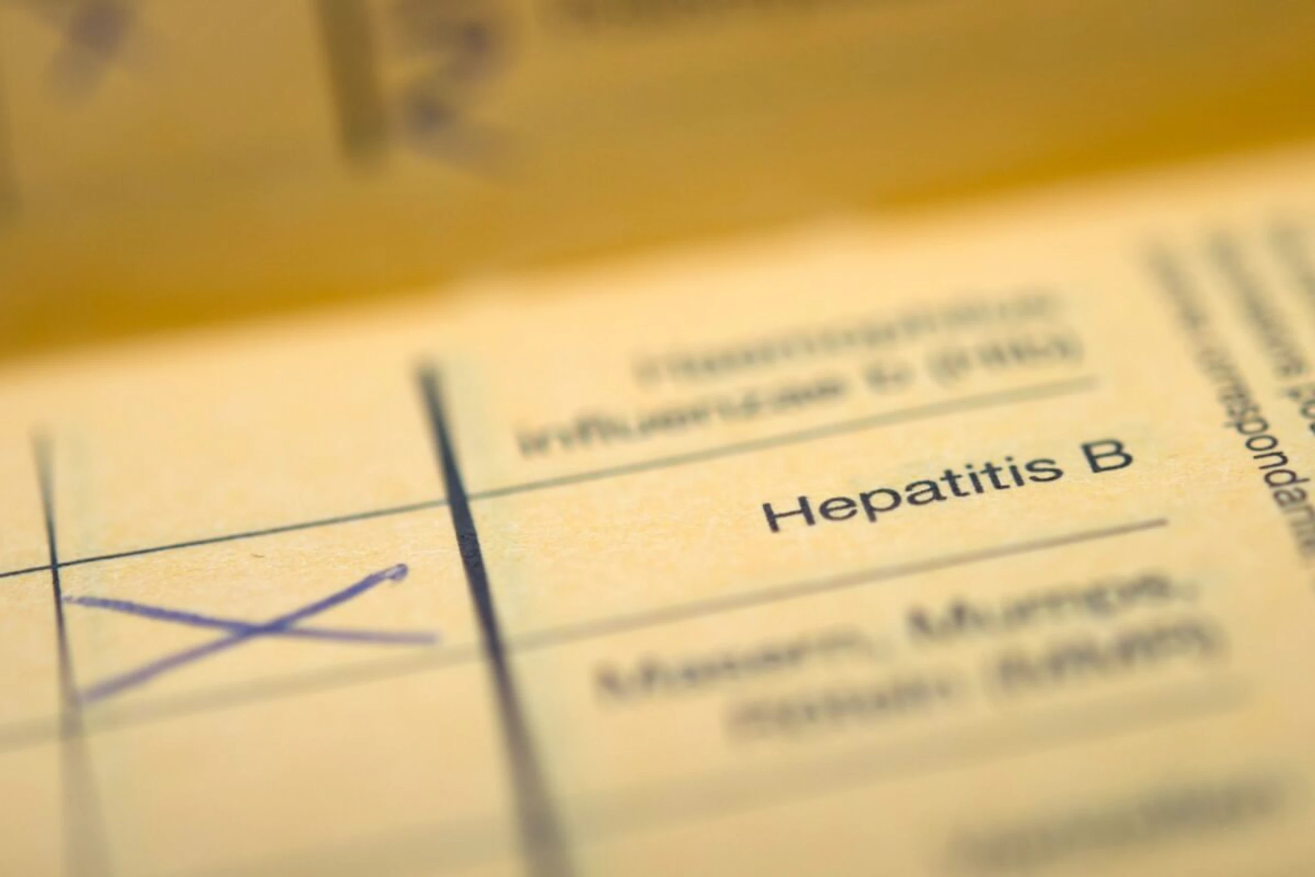 ++ ARCHIVBILD ++ Mit Hepatitis B leben rund 240 Millionen Menschen weltweit