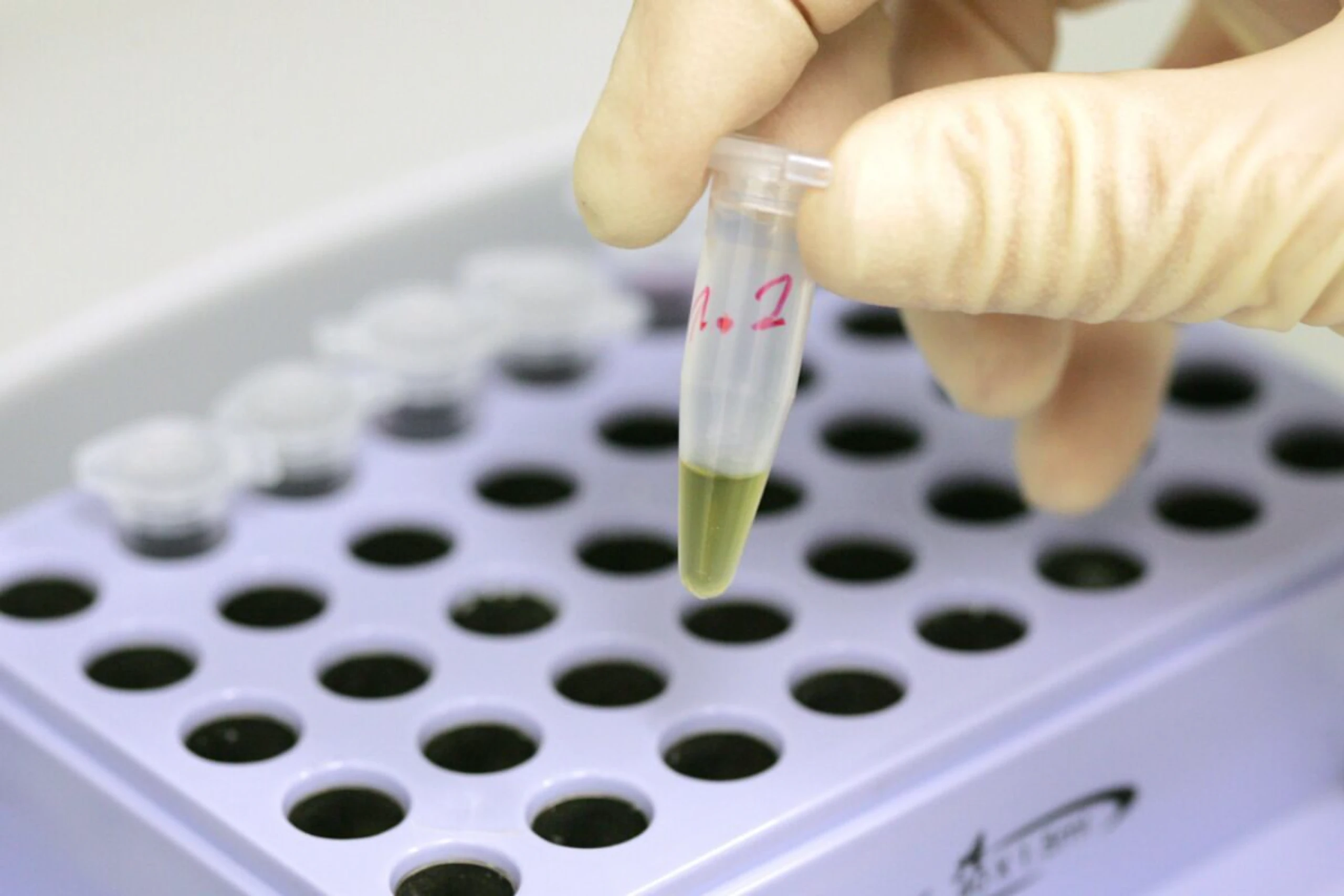 MedUni-Wien-Studie zeigt messbare Veränderungen des Immunsystems
