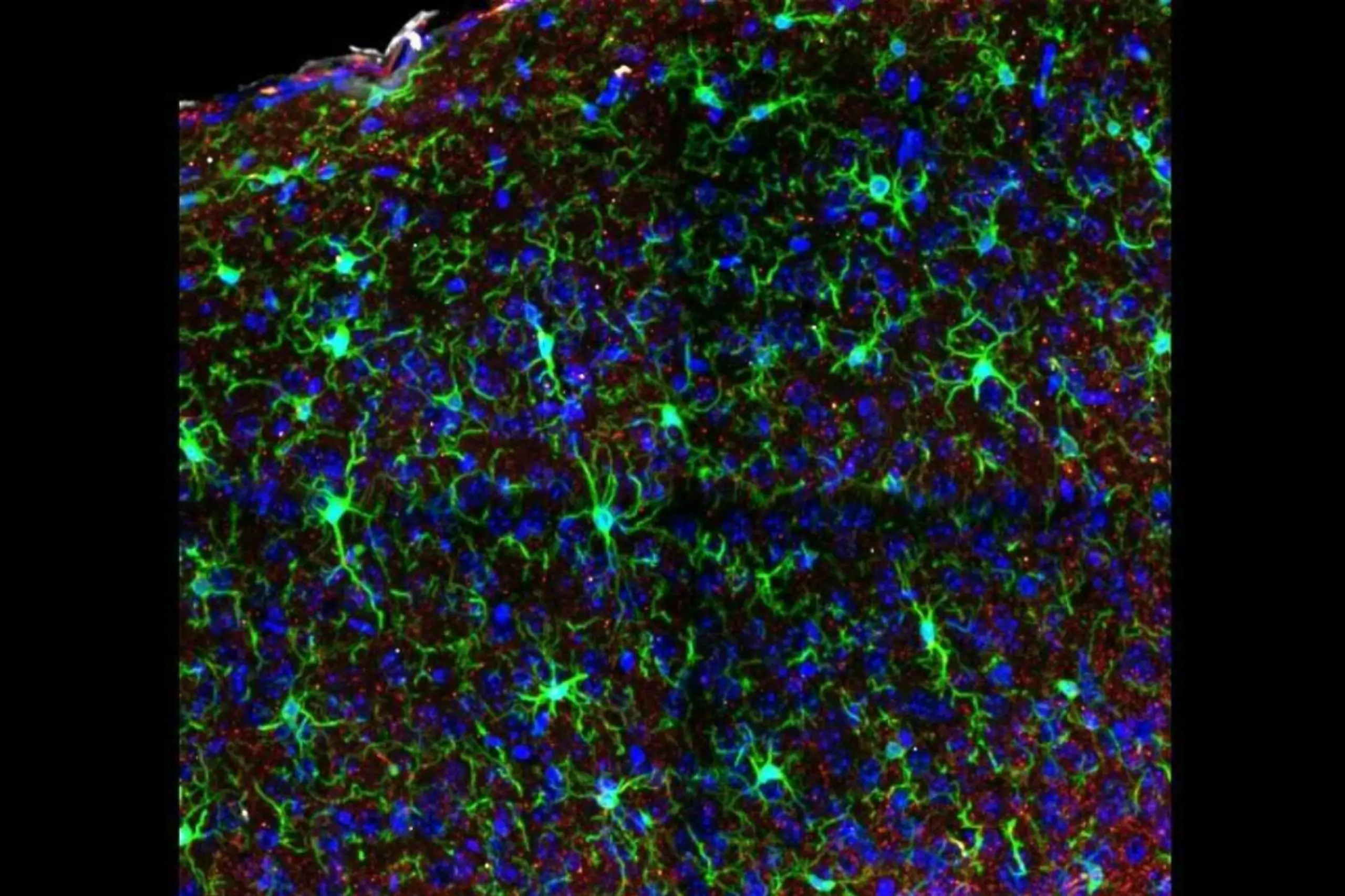 Mikroglia. Das Bild zeigt die Verteilung der Mikroglia (grün) in den verschiedenen Schichten (orange) des visuellen Kortex einer Maus