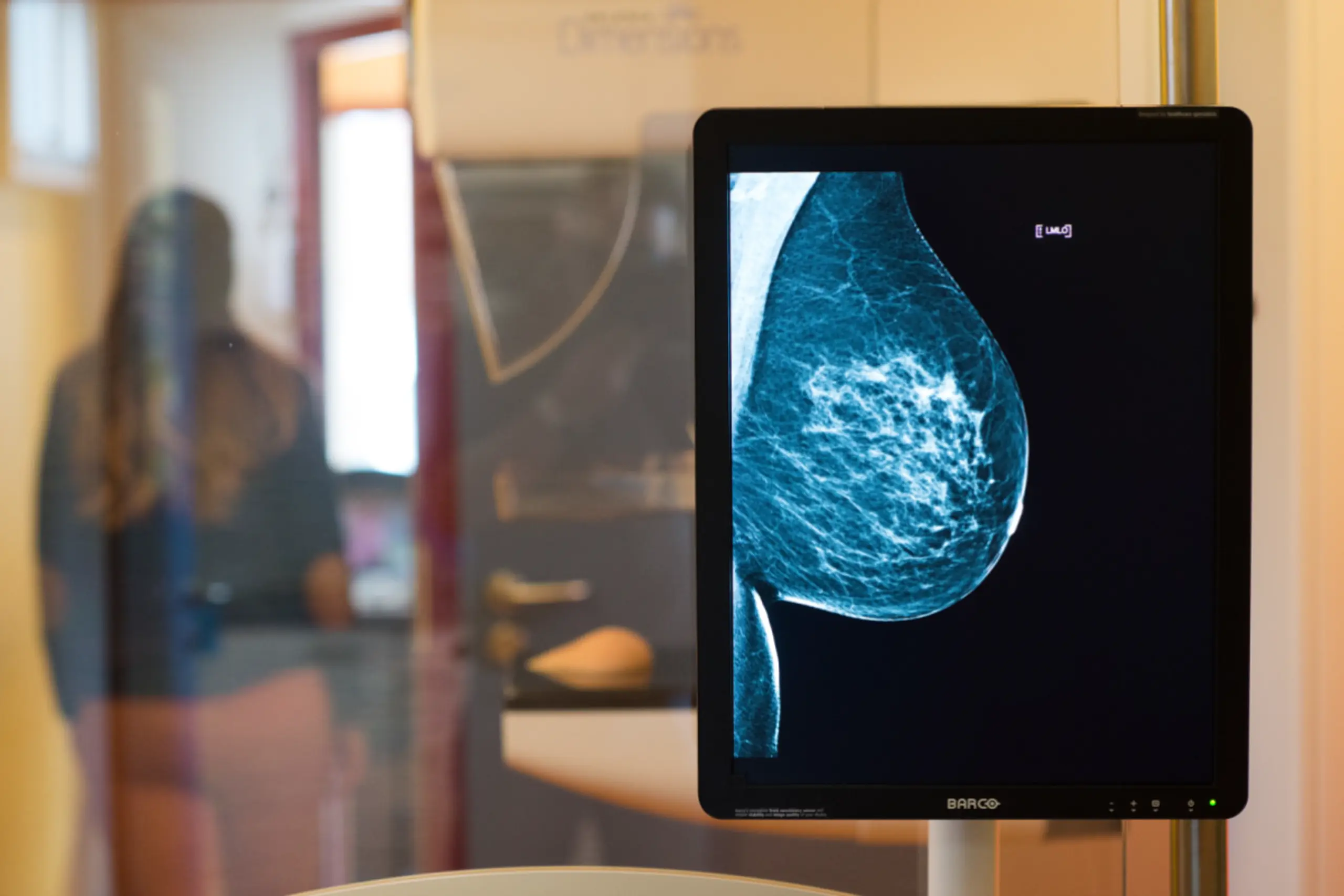 In Österreich werden jährlich 800.000 Mammografien durchgeführt