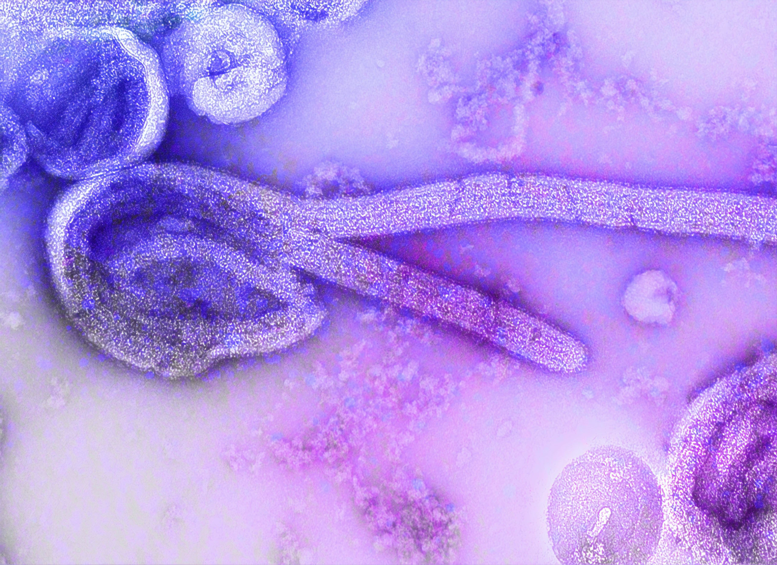 Elektronenmikroskopische Aufnahme eines fadenförmigen Ebola-Viruspartikels